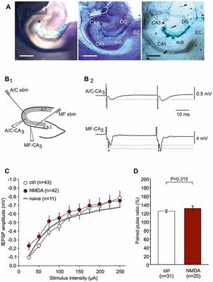 Differentially Altered NMDAR Dependent and Independent Long-Term Potentiation in the CA3 Subfield in a Model of Anti-NMDAR Encephalitis